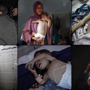 dso gazzede 206 kisi acliktan oldu UzfX57tj